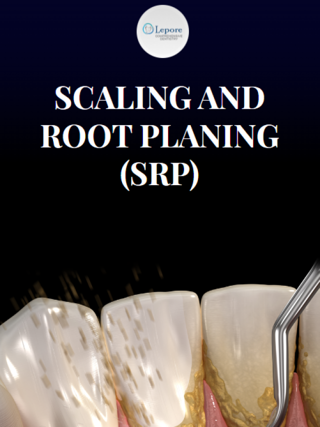 Scaling and Root Planing (SRP)