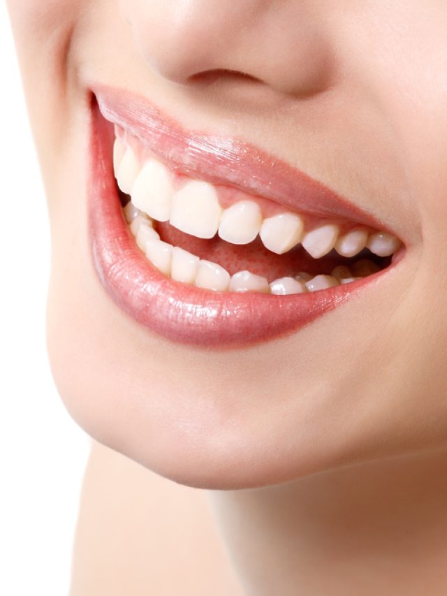 Achieve the smile of your dreams with porcelain veneers.